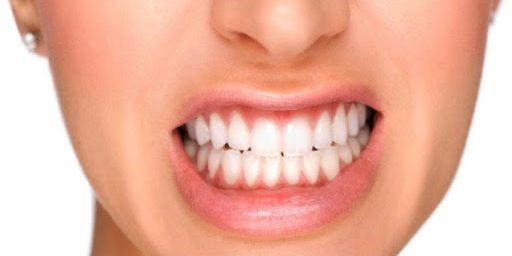 bruxismo-nos-dentes-pode-ser-o-principal-causador