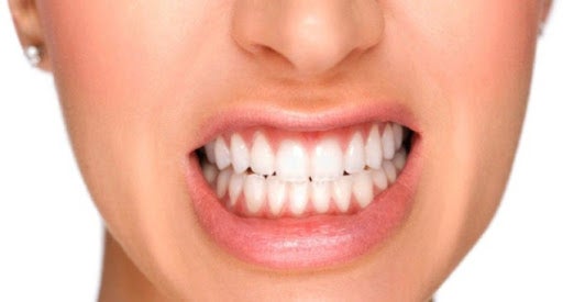bruxismo-nos-dentes-pode-ser-o-principal-causador