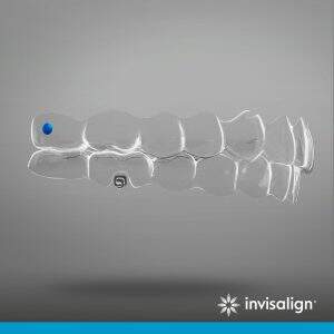 Tratamento Invisalign Consultório Odontológico em Vitória - ES