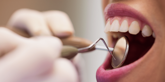 Traumas dentários impedem aplicação de facetas ou lentes de contato?