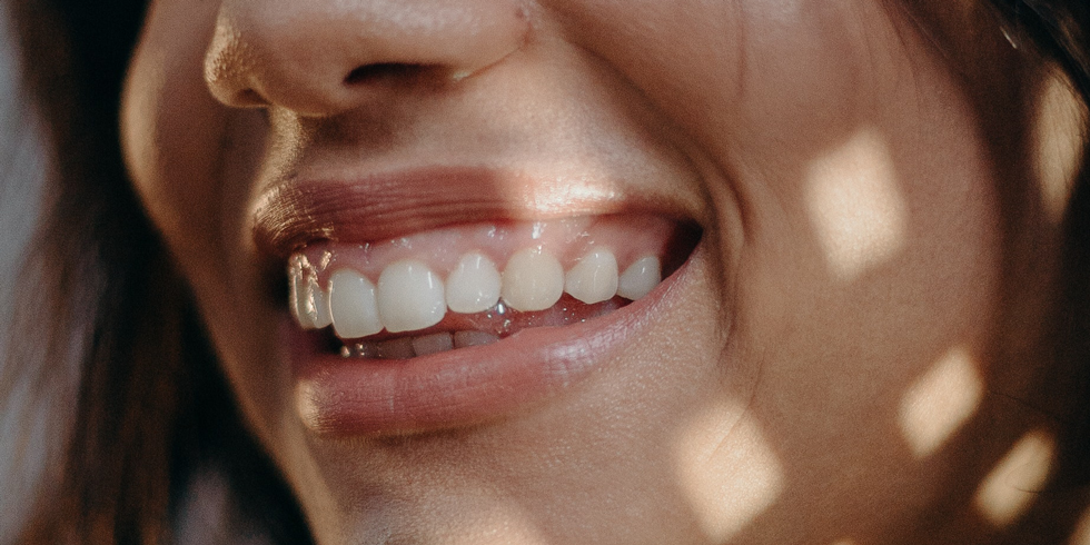 lugao_e_lima_tratamento_para_sorriso_gengival_posterior_qual_e_o_melhor Tratamento para Sorriso gengival posterior – Qual é o melhor?