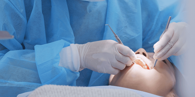 Limpeza-Dentária-em-Clínica-Odontológica-em-Vitória-ES